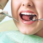 teeth checked