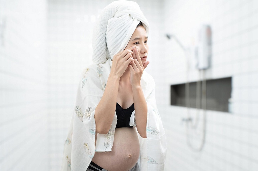 Acne in pregnant women: how to treat it to get rid of it?