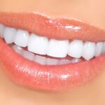 4 tips for beautiful teeth