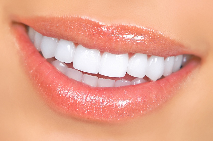 4 tips for beautiful teeth